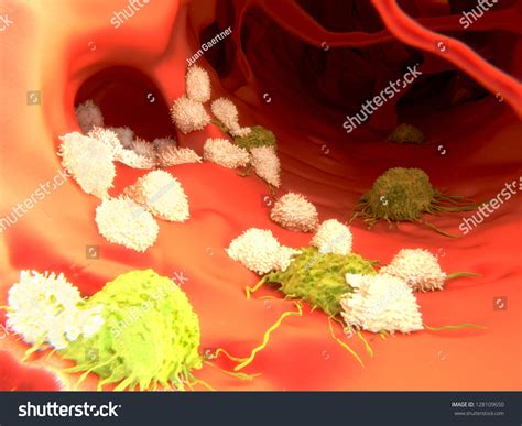 Cytotoxic T-Lymphocytes Attack Migrating Cancer Cells Stock Photo ...