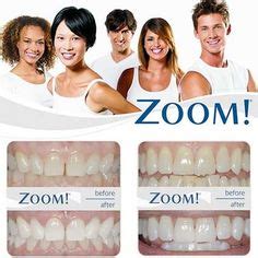 10 Zoom Whitening ideas | zoom whitening, whitening, teeth whitening