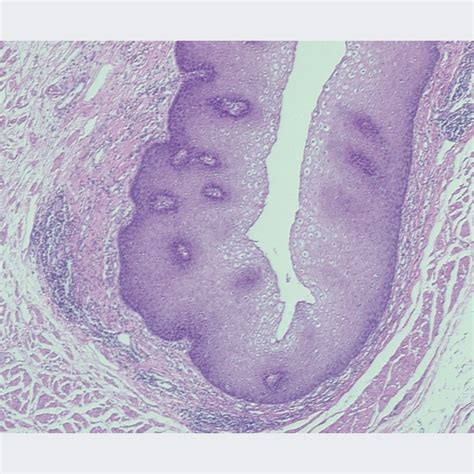 Mammal Stratified Squamous Epithelium Sec M H E Microscope Slide