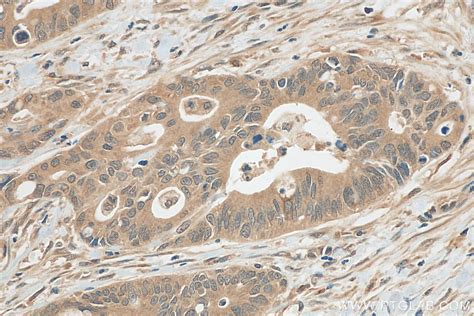 Jnk Antibody 81629 1 Rr Proteintech 武汉三鹰生物技术有限公司