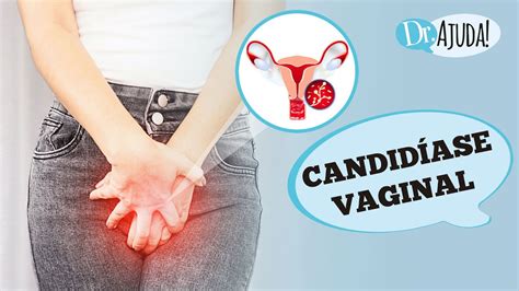 Candid Ase Vaginal O Que Sintomas Diagn Stico Tratatamento E