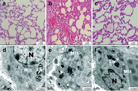 The Light Microscopy View Of The Left Upper Lobe Lung In The S A