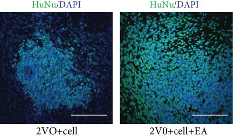 Effect Of EA Treatment On The Survival Of The Grafted MGE Neural