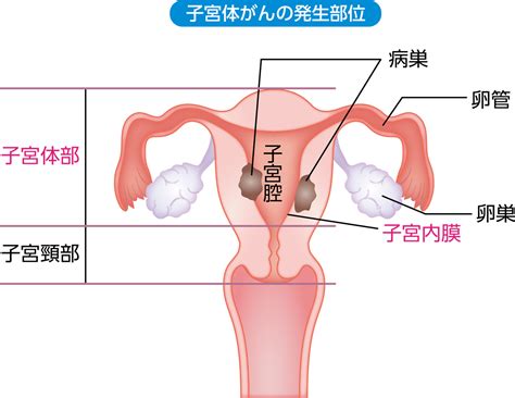 子宮の構造と子宮体がん 子宮体がん Msd Oncology がんを生きる