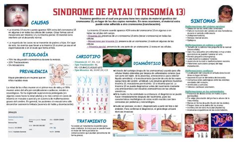 Síndrome de Patau | Esmeralda Castillo Sandoval | uDocz