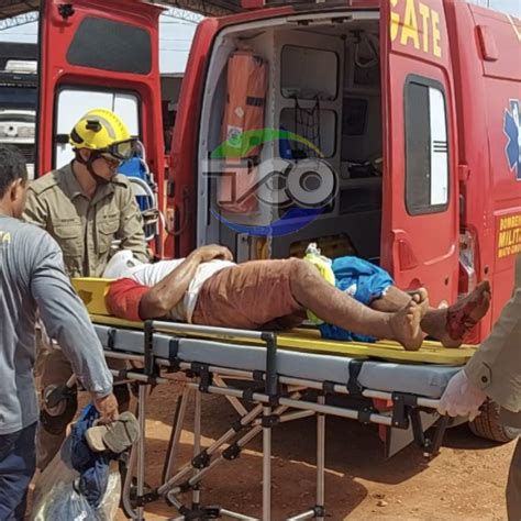 Acidente de trânsito Motociclista é levado para o hospital fratura