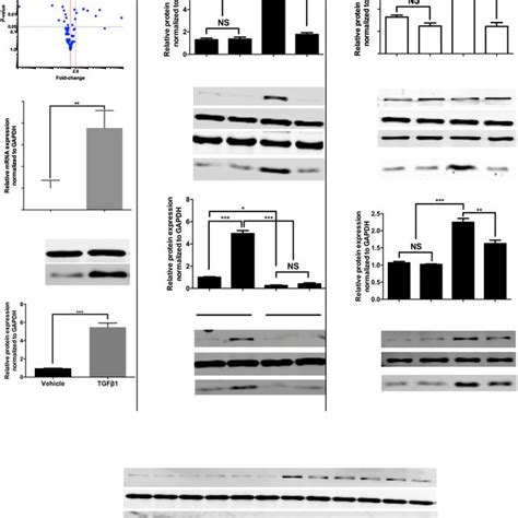 S A And Pai Are Regulated By Smad Dependent Tgf Mediated