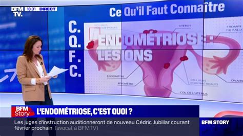 Qu est ce que l endométriose dont souffre une femme sur dix en France