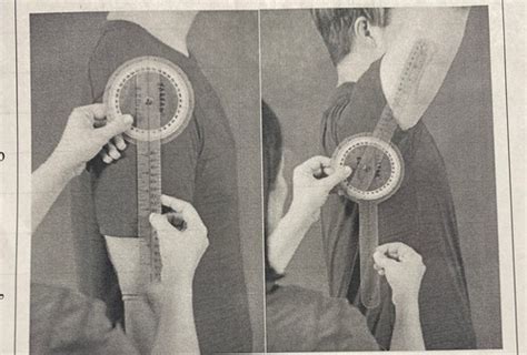Goniometry Flashcards Quizlet