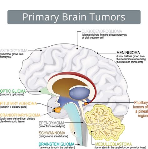 Support Gray: The Brain Tumor Symbol