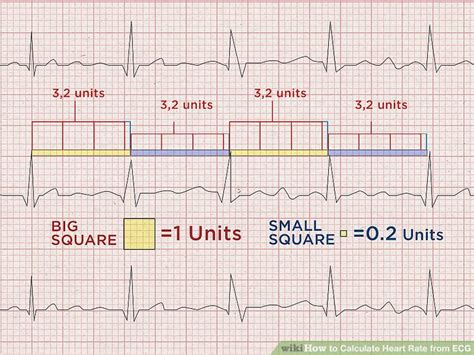 How to Calculate Heart Rate from ECG: 8 Steps (with Pictures)