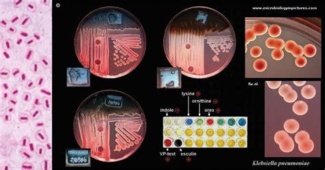 Klebsiella pneumoniae- Lab Diagnosis, Treatment, Prevention