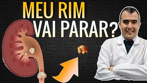 Quando Uma PEDRA NO RIM Prejudica Para Sempre O Seu Funcionamento YouTube