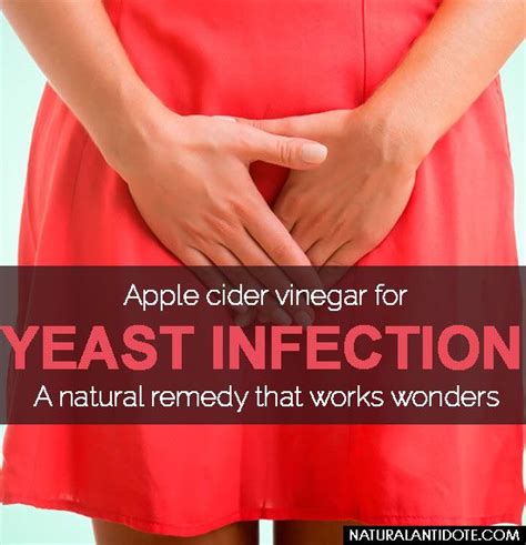 Apple Cider Vinegar For Yeast Infection A Natural Remedy That Works Wonders Apple Cider