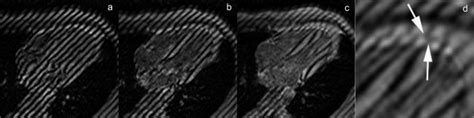 Cmr Tagging Using The Spamm Spatial Modulation Of Magnetization