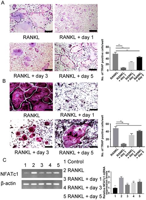 Carnosol Inhibits Osteoclastogenesis In Vivo And In Vitro By Blocking