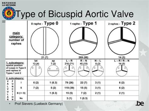 Ppt Aortic Bicuspid Valve In Flight Crew Case Reports And Free Nude