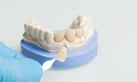 Step By Step Guide To Dental Crown Procedures