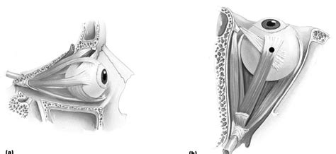 anatomy lab 9 - eye muscles Diagram | Quizlet