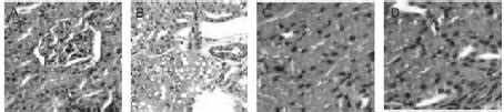 Application Of Tetramethylpyrazine To Preparation Of Medicine For