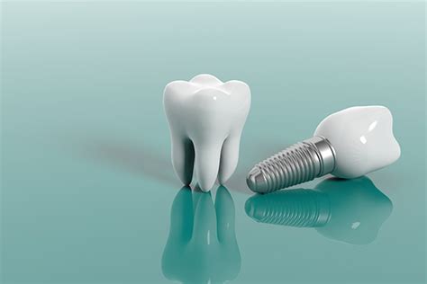 Securely Replace Missing Teeth With Dental Implants Palm Beach