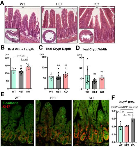 Ptpn Is A Critical Regulator Of Ileal Paneth Cell Viability And