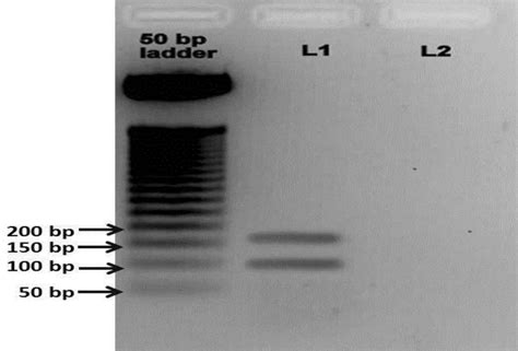 Fast Multiplex PCR protocol for SARS-CoV-2 detection: gel... | Download Scientific Diagram