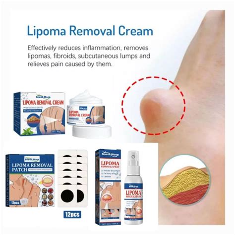 South Moon Lipoma Cream G Lipoma Spray Ml Patch Pcs Benjolan