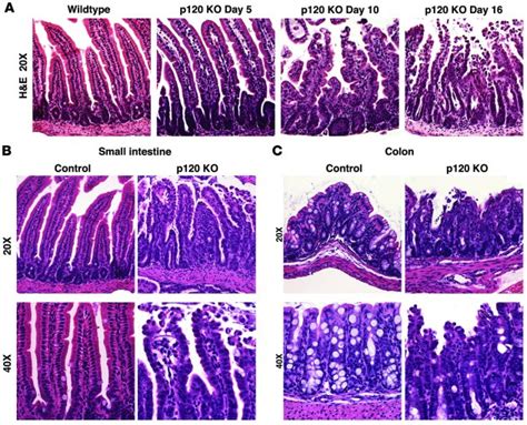 Jci P Catenin Is Essential For Maintenance Of Barrier Function And