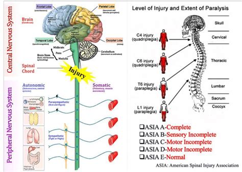 Non Traumatic Spinal Cord Injury Chiropractic Scientists 915 850 0900