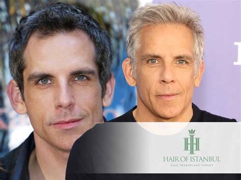 Ben Stiller Hair Transplant Speculations: Rumors Examined! | Hair of ...