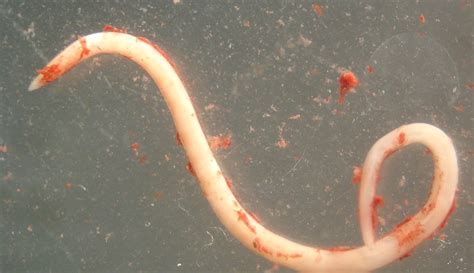 Parasite Of The Day April 22 Anisakis Nascettii