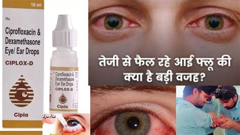 Ciplox D Eye Ear Drops Ciprofloxacin Dexamethasone Eye Ear Drops Ciplox