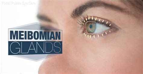 Meibomian Gland Dysfunction Focal Pointe Eye Care