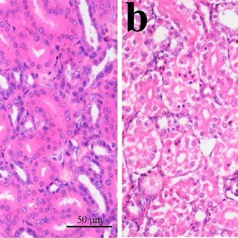 Morphological changes of apoptotic cells. (a) In the apoptotic cell ...