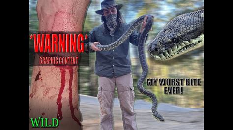 My Worst Bite Ever WILD Snake Catchers YouTube