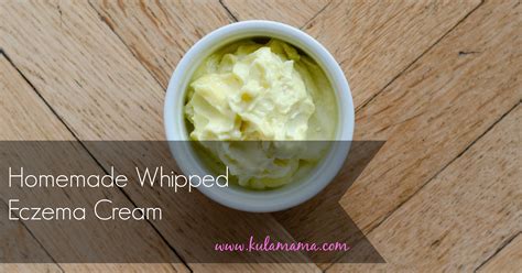 homemade eczema cream