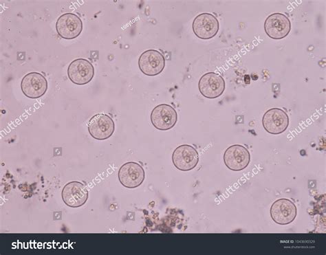 Protozoa Stool Entamoeba Coli ภาพสต็อก 1043690329 Shutterstock