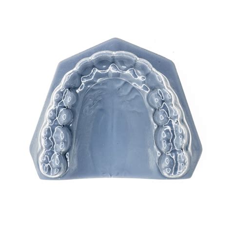 Clear Retainers - Motif Orthodontic Arts