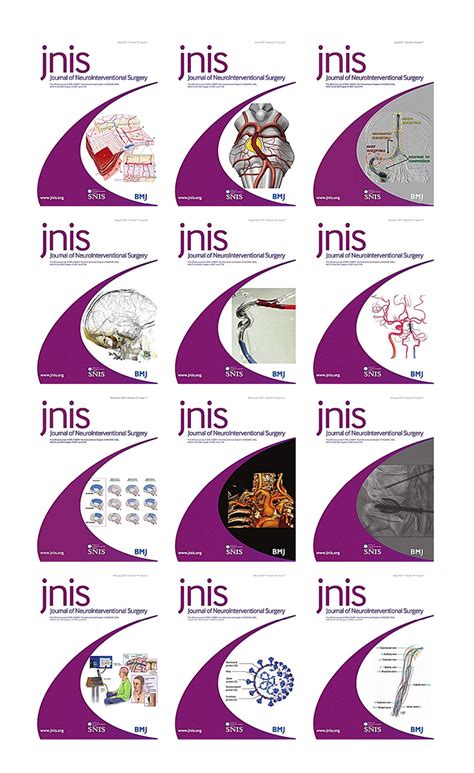 Journal Of Neurointerventional Surgery Full Archives True Pdf