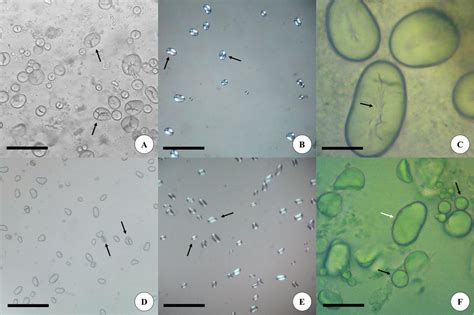 Potato Starch Under Microscope