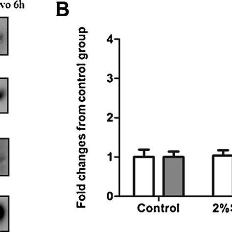 Western Blot Analysis Of Apoptotic Enzyme Cl Csp3 From Frontal Cortex