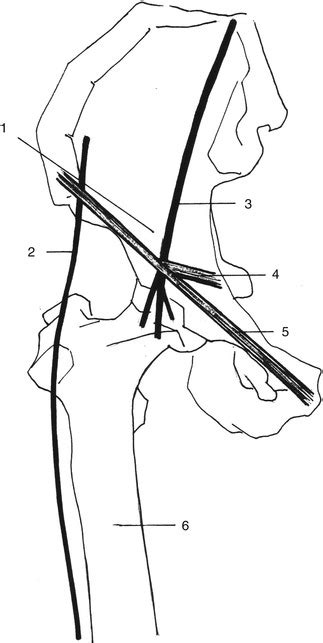 Peripheral Nerve Entrapment Syndromes of the Lower Extremity | Neupsy Key