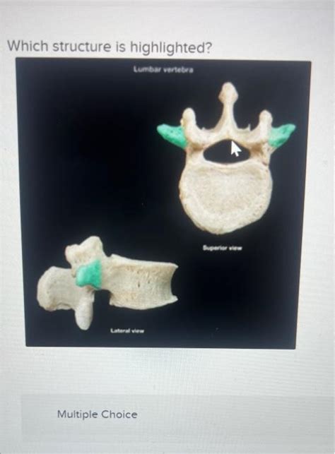 Solved Which Structure Is Hiahliahted Multiple Chegg