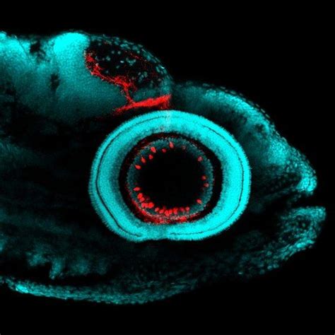 Zebrafish Retina IMAGE EurekAlert Science News Releases