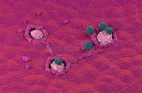 Car T Cell Therapy In Colon Colorectal Cancer Crc Isometric View 3d Illustration Stock