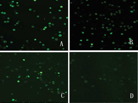 Intense Picosecond Pulsed Electric Fields Induce Apoptosis Through A