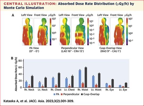 Body Surface Radiation Exposure In Interventional Echocardiographers