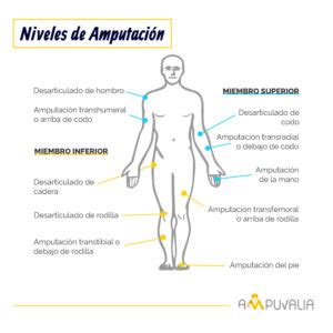 Infografia Ampuvalia Niveles O Tipos De Amputacion Ampuvalia