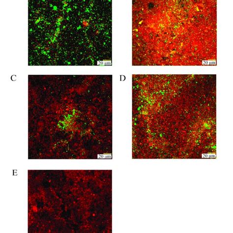 Confocal Laser Scanning Micrographs After 72 H Of Growth On Titanium